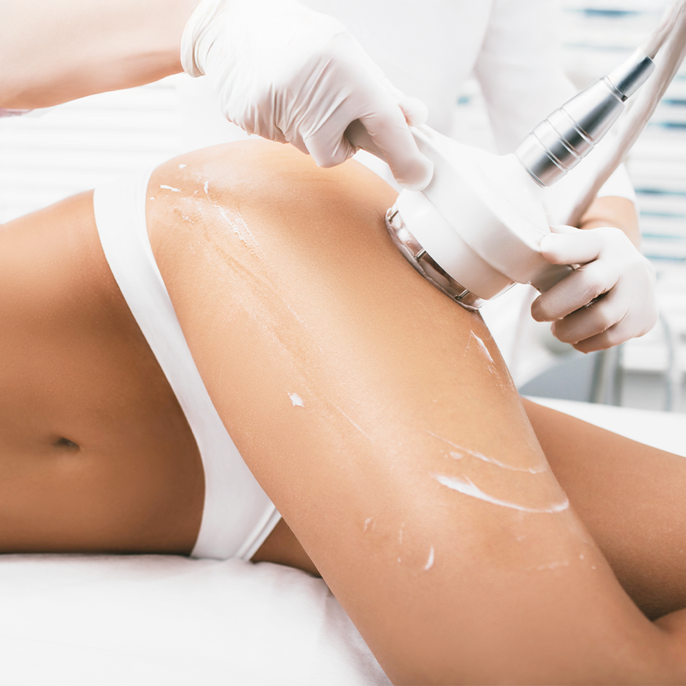 RF & Lipo Melt Cavitation